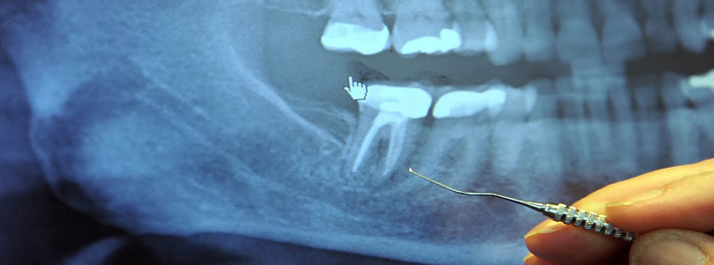 解りやすいご説明