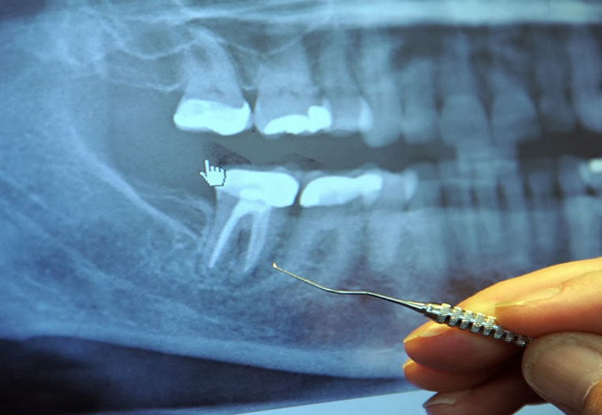 丁寧な診査診断